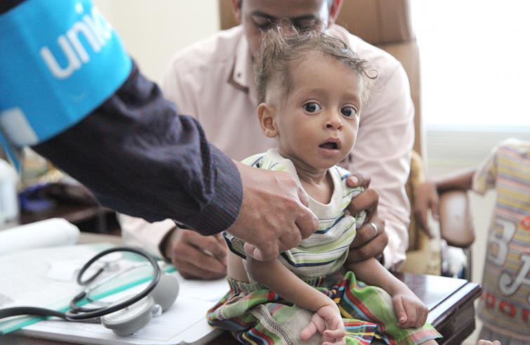 unicefyemen-child-malnutrition-755x491.jpg